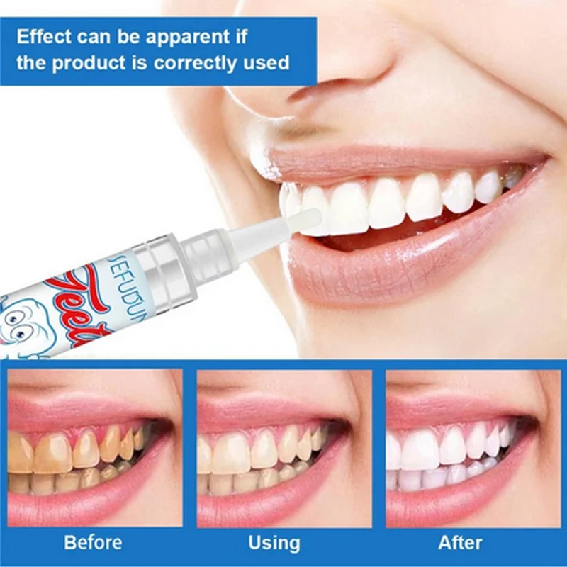 

Teeth Whitening Pen Professional Teeth Gel Whitener Bleach Remove Stains Oral Hygiene Tooth Hygiene Care Tools Teeth Cleaning