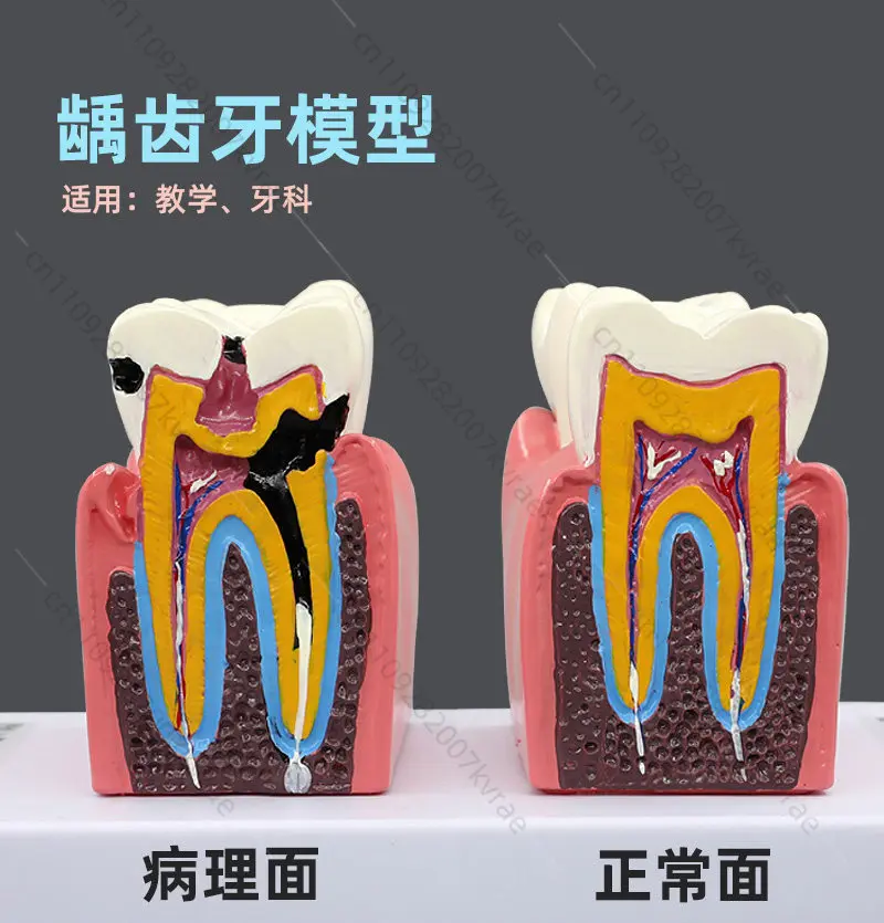 

Big Dental Teeth Model Anatomy Large Dental Anatomical Model For Teaching Studying Education Demonstration Patient Communication