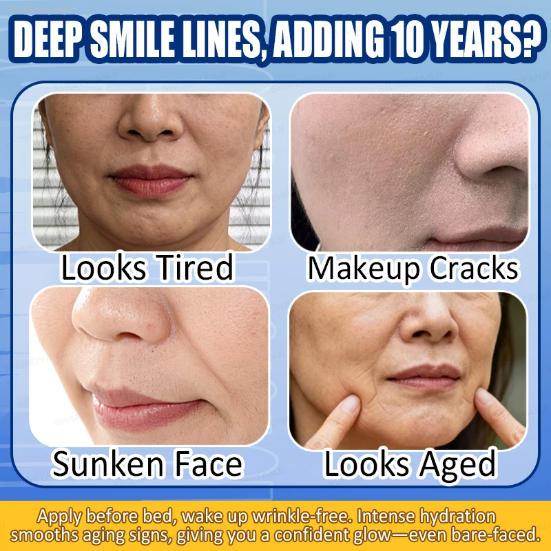 Instant Anti Wrinkle Patches Face Lifting Pads Fade Smile Lines Nasolabial Folds Firming Skin Care Quick Repair Moisturizing Mask Eliminate Fine Lines First Aid Beauty Patch For Daily Routine
