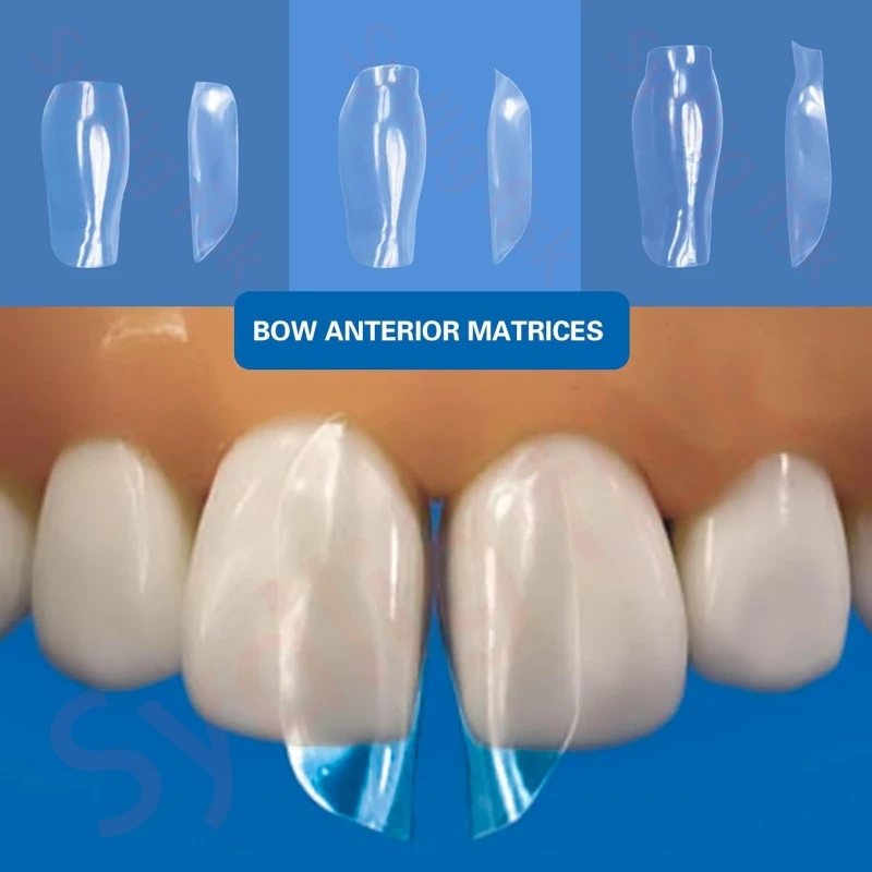 10Pcs/box Dental Clear Matrix Matrice BT Bow Anterior Matrices Front Matrices Fits Bioclear Style S/M/L Dentistry Materials
