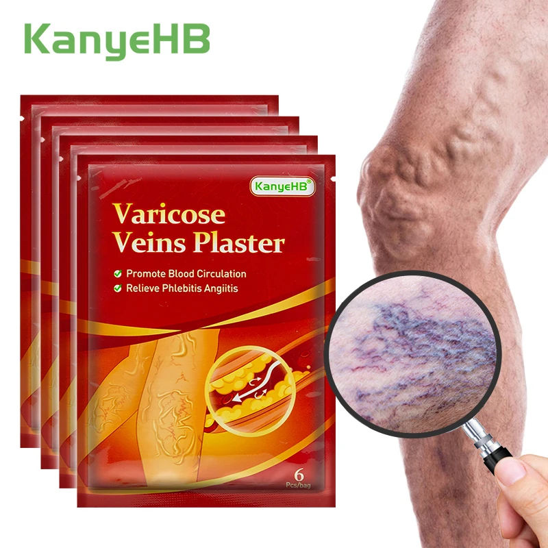 

24pcs=4bags Varicosity Plaster Varicose Veins Patch Relieve Swelling Blood Vessel Veins Swelling Pain Enhance Vascular Wall A595