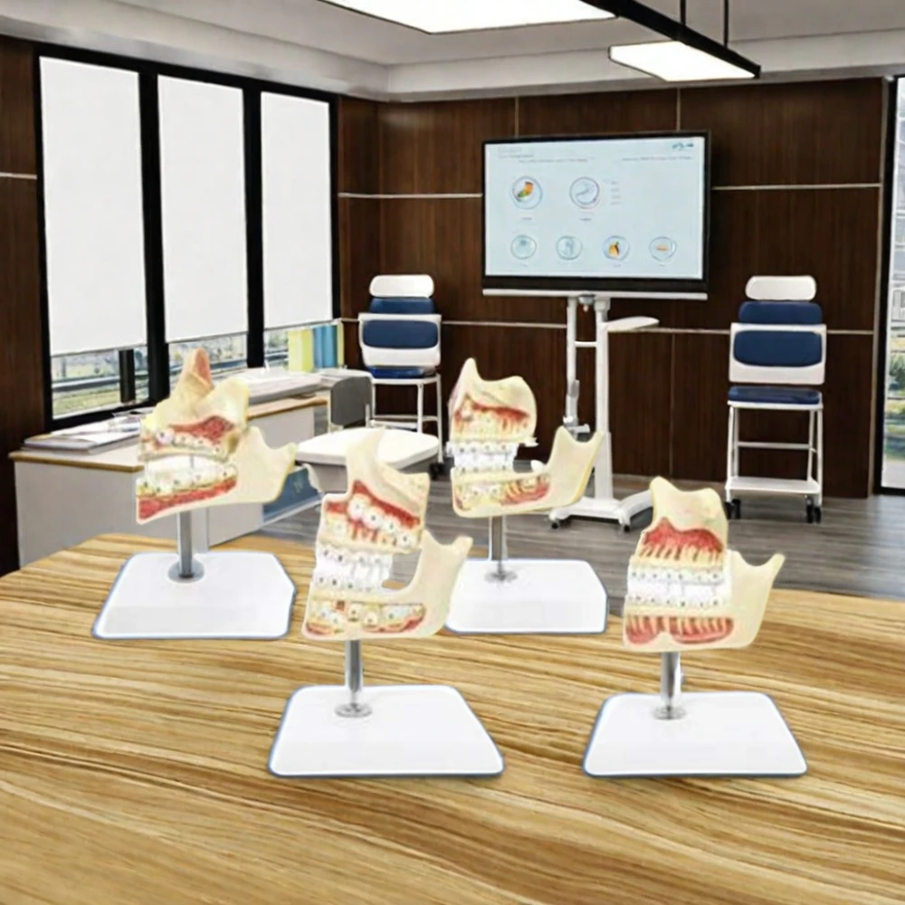 4-Stage Dental Development Teeth Model Medical Science Teaching Demonstration PVC Material