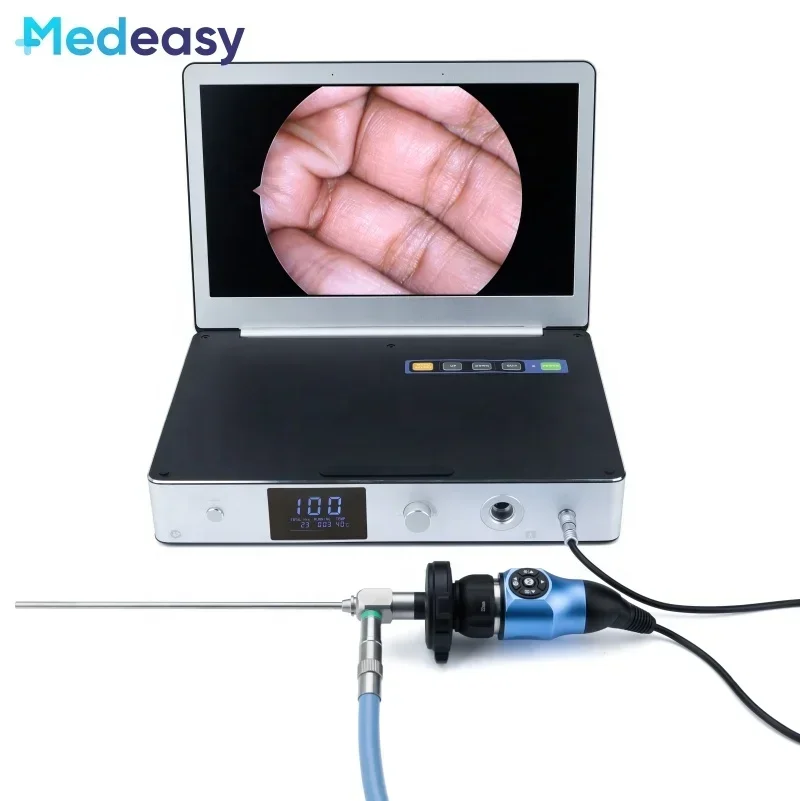 11.6 Inch Portable Full HD medical endoscopy camera system with Monitor and 30W LED Light Source/ medical endoscope camera