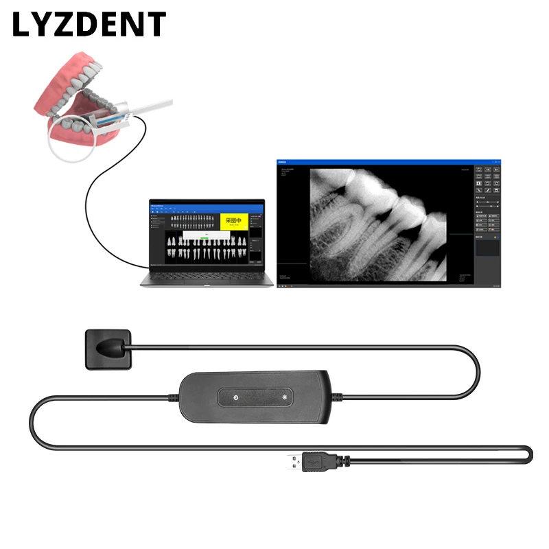 Dentistry Dental Sensor X-Ray High-Frequency Rx Digital Intraoral Digital System H D Image Radiovisografo Dentist Implant Tools