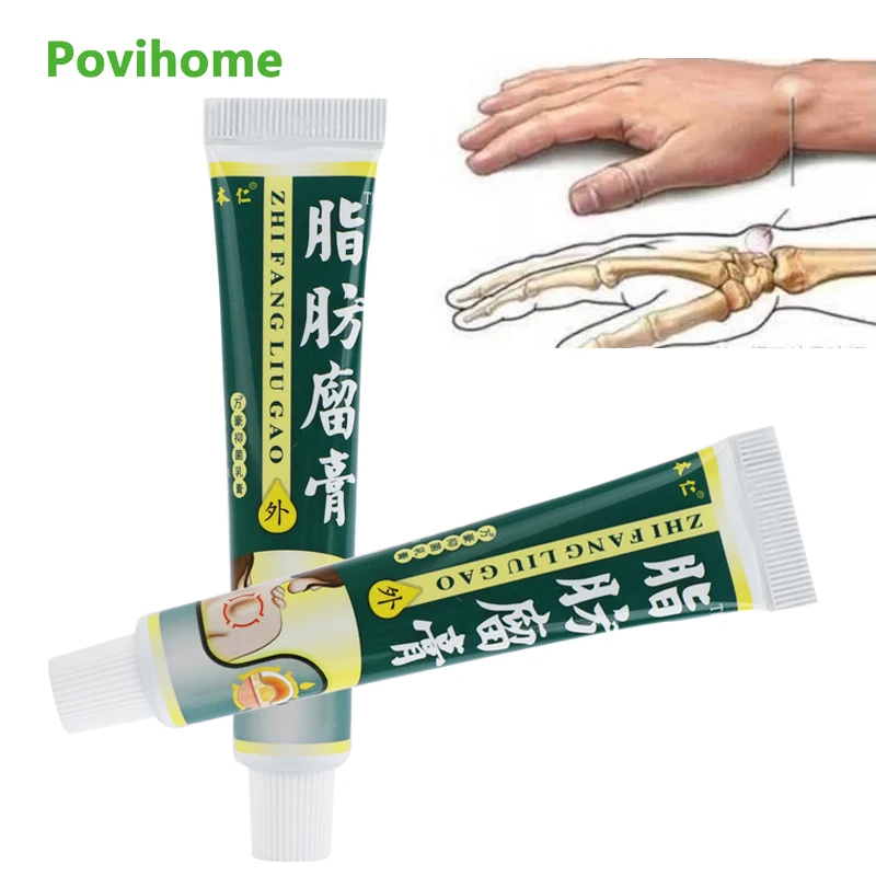 20g Lipoma Remover Medicines Cream Cellulite Treatment Plaster for Subcutaneous Lumps Fat Mass Fibroma Anti-swelling Ointment