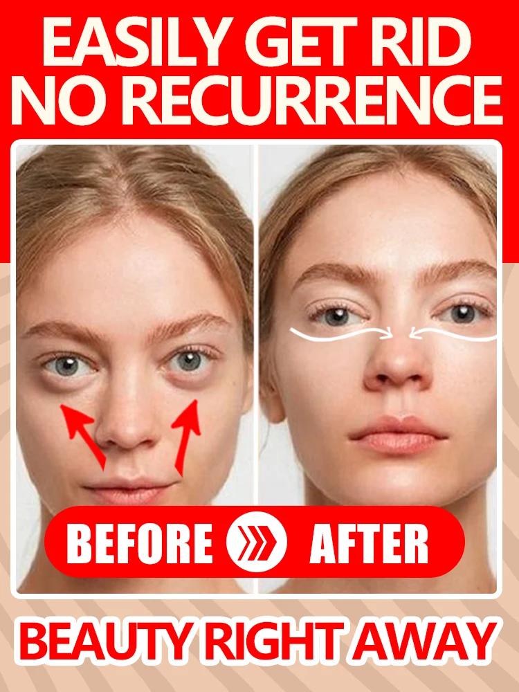 

Snail Eye Cream Collagen Firming Eye Bags Fade Fine Lines Wrinkle Lightening Dark Circles Puffiness Eye Cream