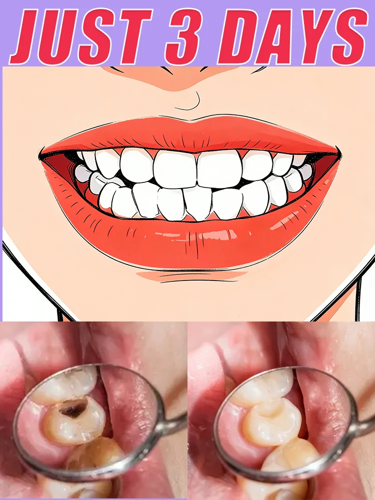 Adult Anti-Cavity Toothpaste: Prevents Cavities, Repairs Tooth Enamel, Removes Stains, and Freshens Breath.