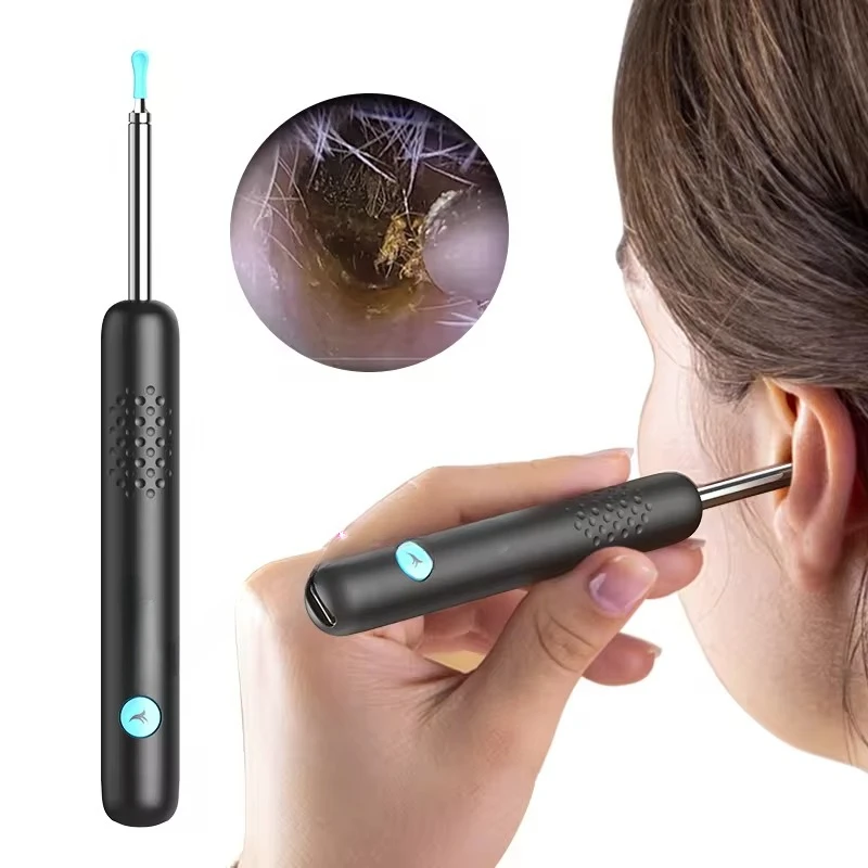 smart visual earwax removal visible otoscope ear cleaner cleaning rod  kit for adults kids & pets