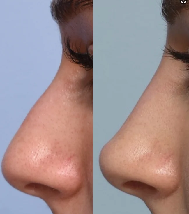 linea-di-spedizione-gratuita-per-il-naso