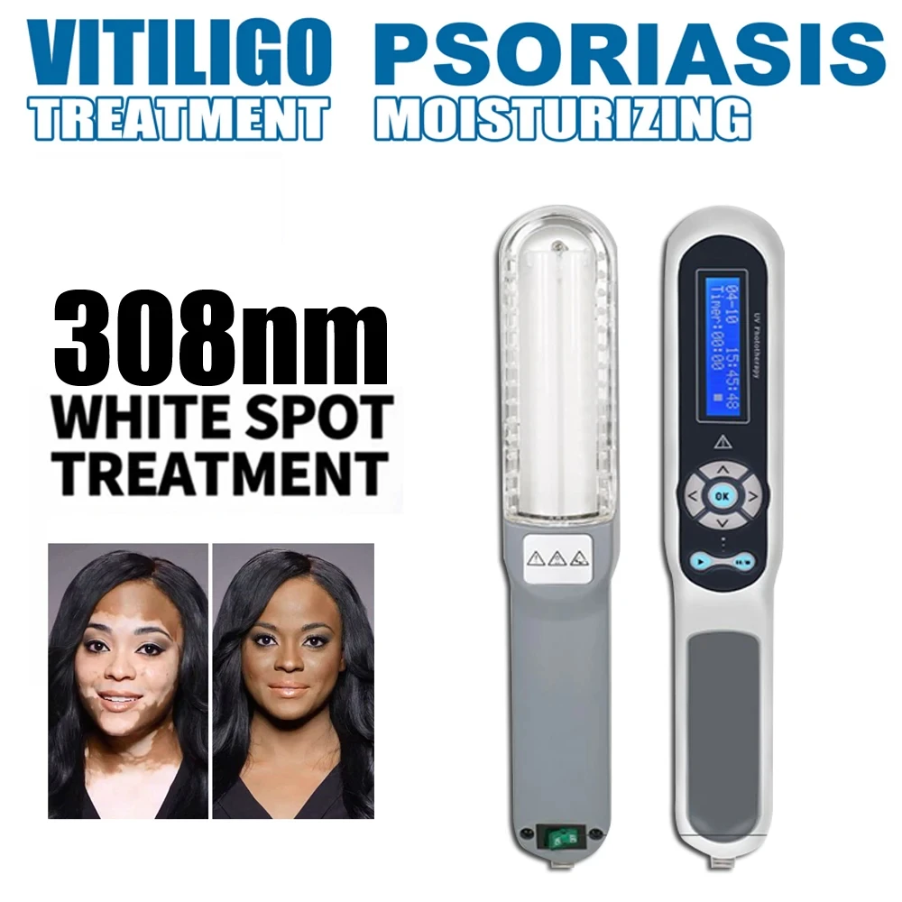 308nm Handheld uvb Light Therapy Portable Effective To Treat vitiligo Psoriasis Eczema Uvb Lamps Uv Phototherapy Instrinstrument