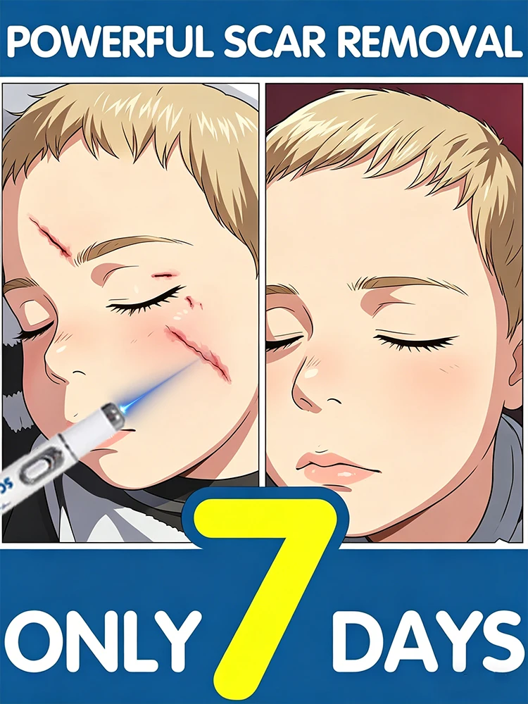 2 Generation Laser Pens to Solve Your Scar Problems and Keep Your Skin Healthy
