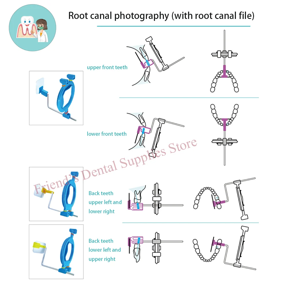 Dental röntgen feste Klammer Röntgen position ierer Dental filmtyp, Film maschine und Dental films chatz sind verfügbar, 12 teile/schachtel