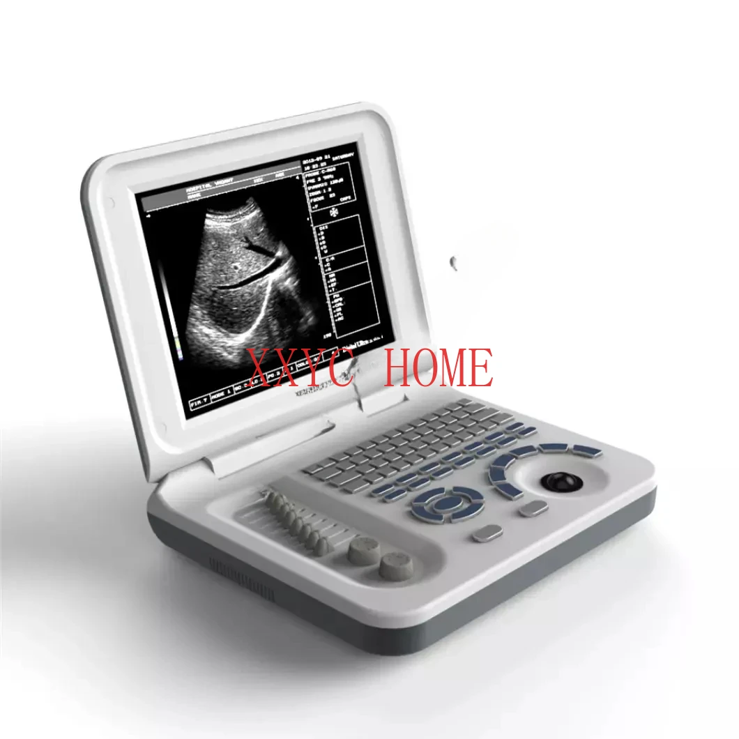 

Medical Full Digital Ultrasonido medico Price & B&W Portable Ultrasound Scanner Machine With convex array probe