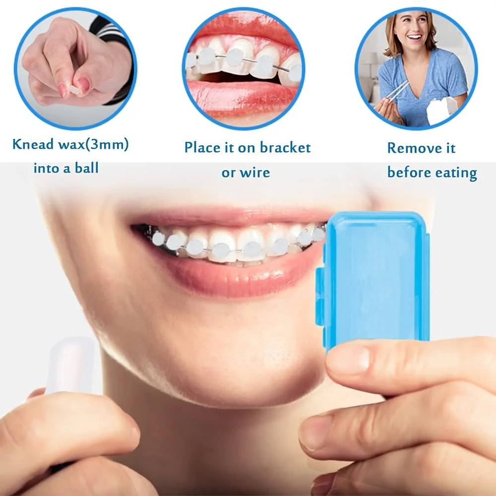 AG 10Box Dental Fruit Flavor Wax Orthodontic Correction Wax Braces Gum Relief Gum Pain Oral Hygiene Teeth Whitening Care Tools