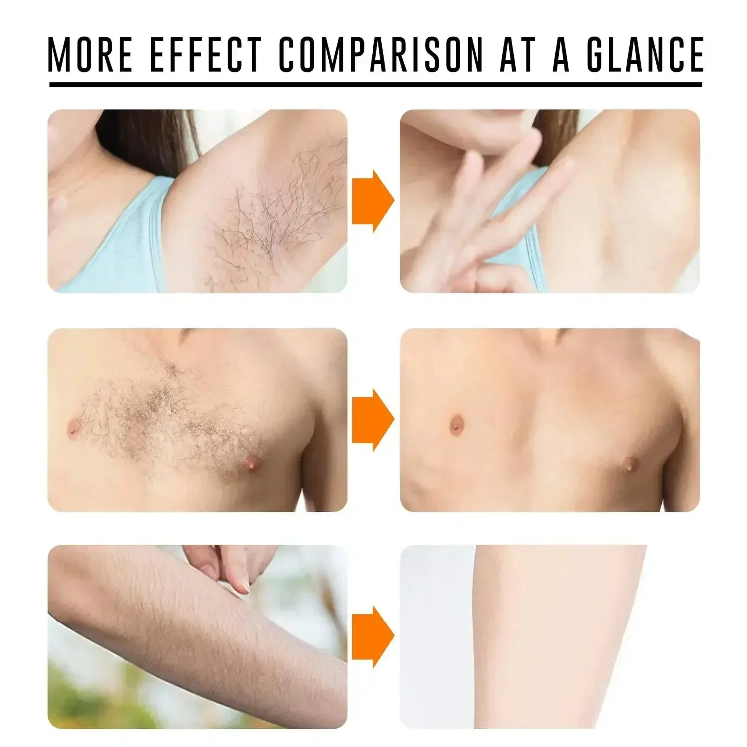 2 دقائق إزالة الشعر السريع رذاذ غير مؤلم مثبط نمو الشعر الذراع الإبط الساق مزيل الشعر الدائم للرجال النساء إصلاح الرعاية #2