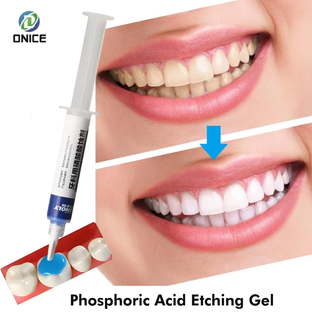 

Стоматологический 35% гель для гравировки синей фосфорической кислоты — коробка 5 мл для лечения эмали и Dentin, ортодонтическое использование