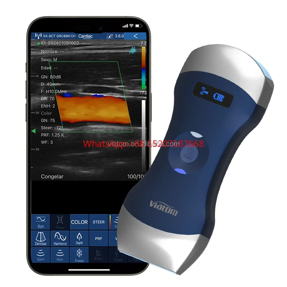 Scanner à ultrasons Doppler portable sans fil, 3 heures, batterie, temps de travail, 128 éléments, déterminer la sonde à ultrasons