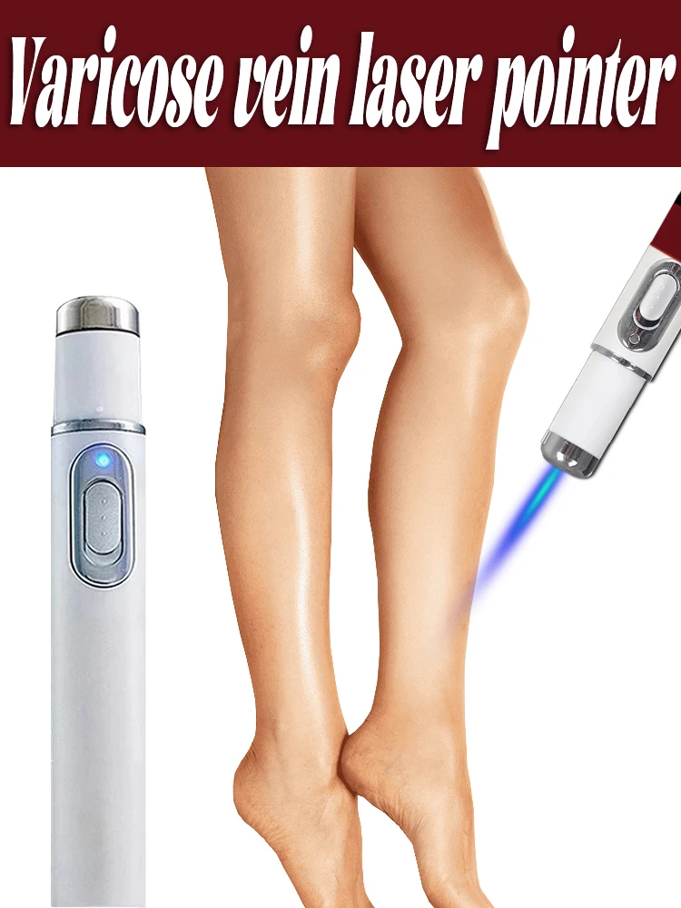 第2世代レーザー静脈治療ペン、静脈瘤の治療に使用されます。