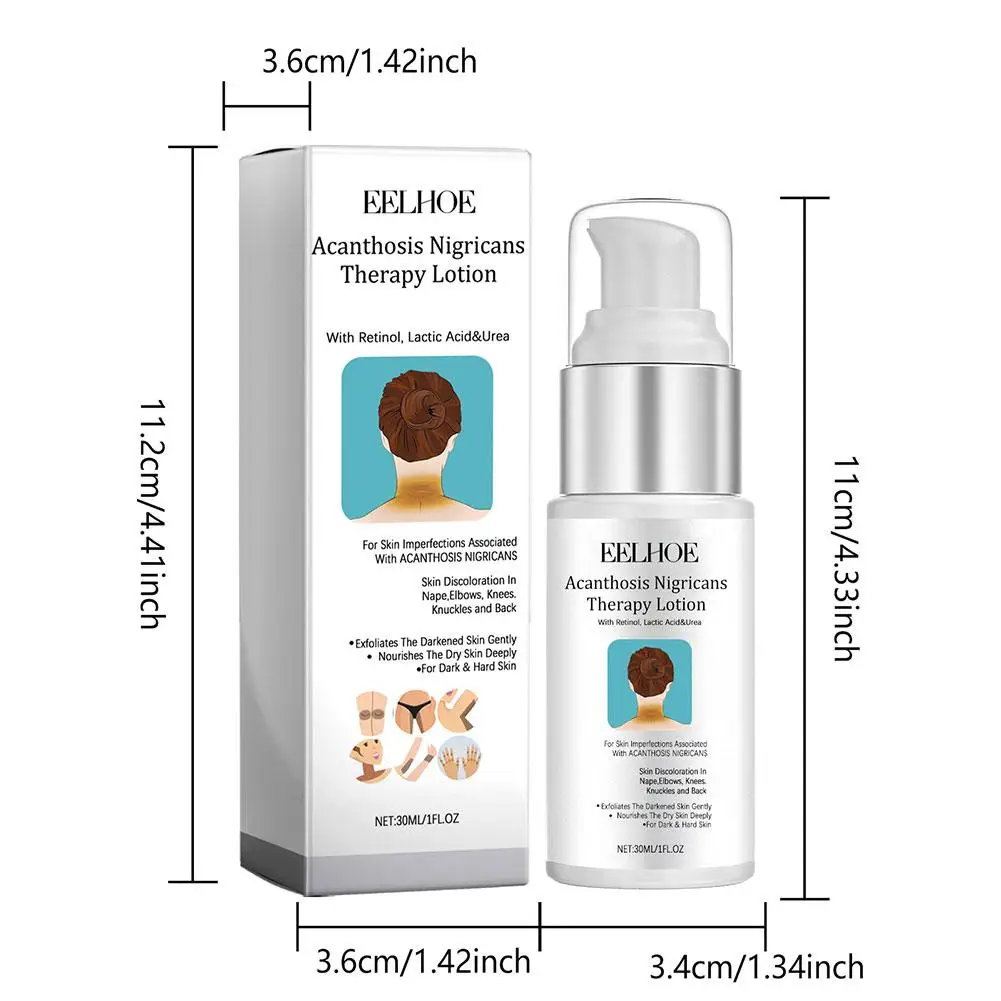 Body Whitening Cream Bleekmiddel Donkere Knokkel Oksels Elleboog Kniebenen Voeden Fleuren Huid Toon Exfoly Lichter Heet