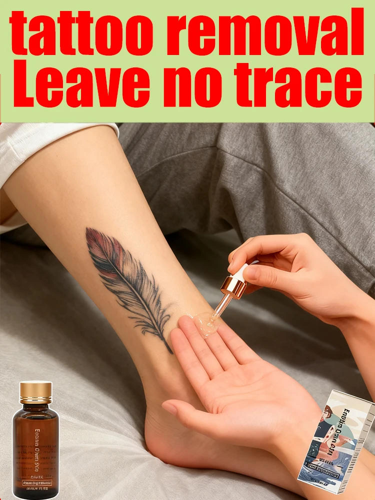 قم بإزالة الوشم في 7 أيام فقط #1