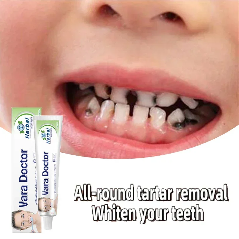 Toothpaste Remover Dental Calculus Whitening Teeth Mouth Odor Removal Bad Breath Preventing Periodontitis Dental Care Toothpaste