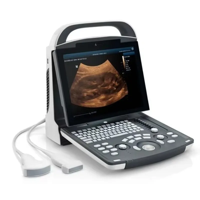 Portable Medical Ultrasound Instruments Human Use Mindray DP10  Black and White  Ultrasound Machine Price  Veterinary Scanner