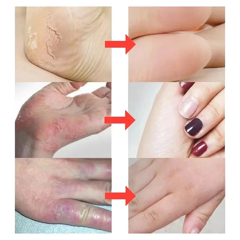 Thumbnail 2 - #75 Compare Hand Care Before You Buy