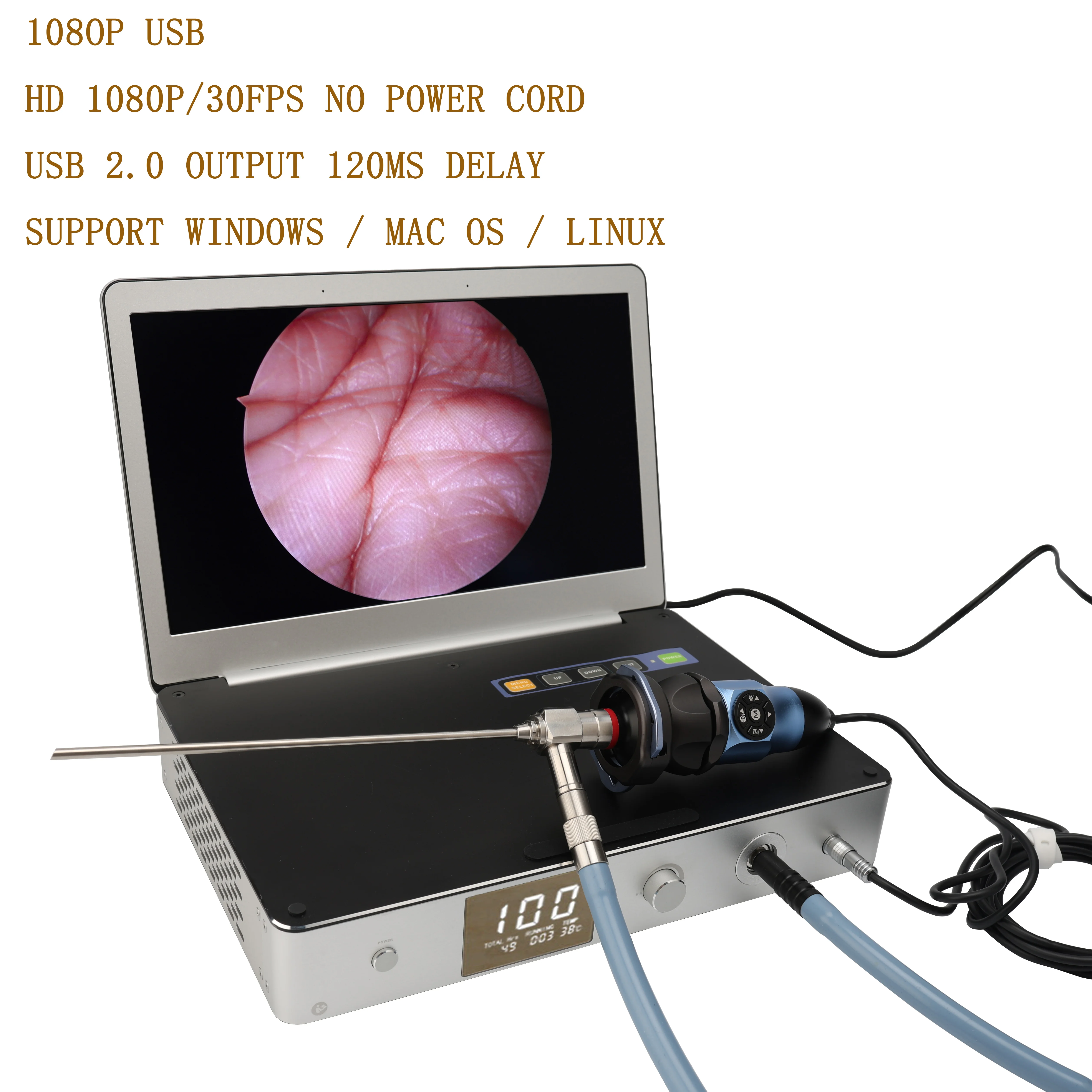 Full HD portable medical USB endoscope camera  ear nasal usb Laparoscopic Gynecology