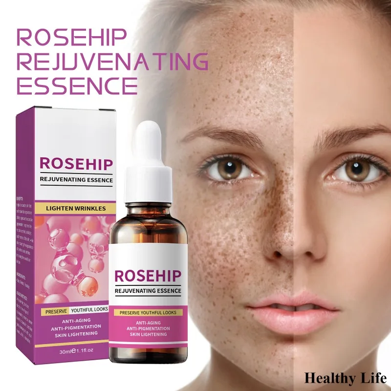 Retinol Anti-aging Face Serum Women Effective Freckles Essence Fade Fine Lines Instant Wrinkle Remover Remove Spots Rosehip Oil