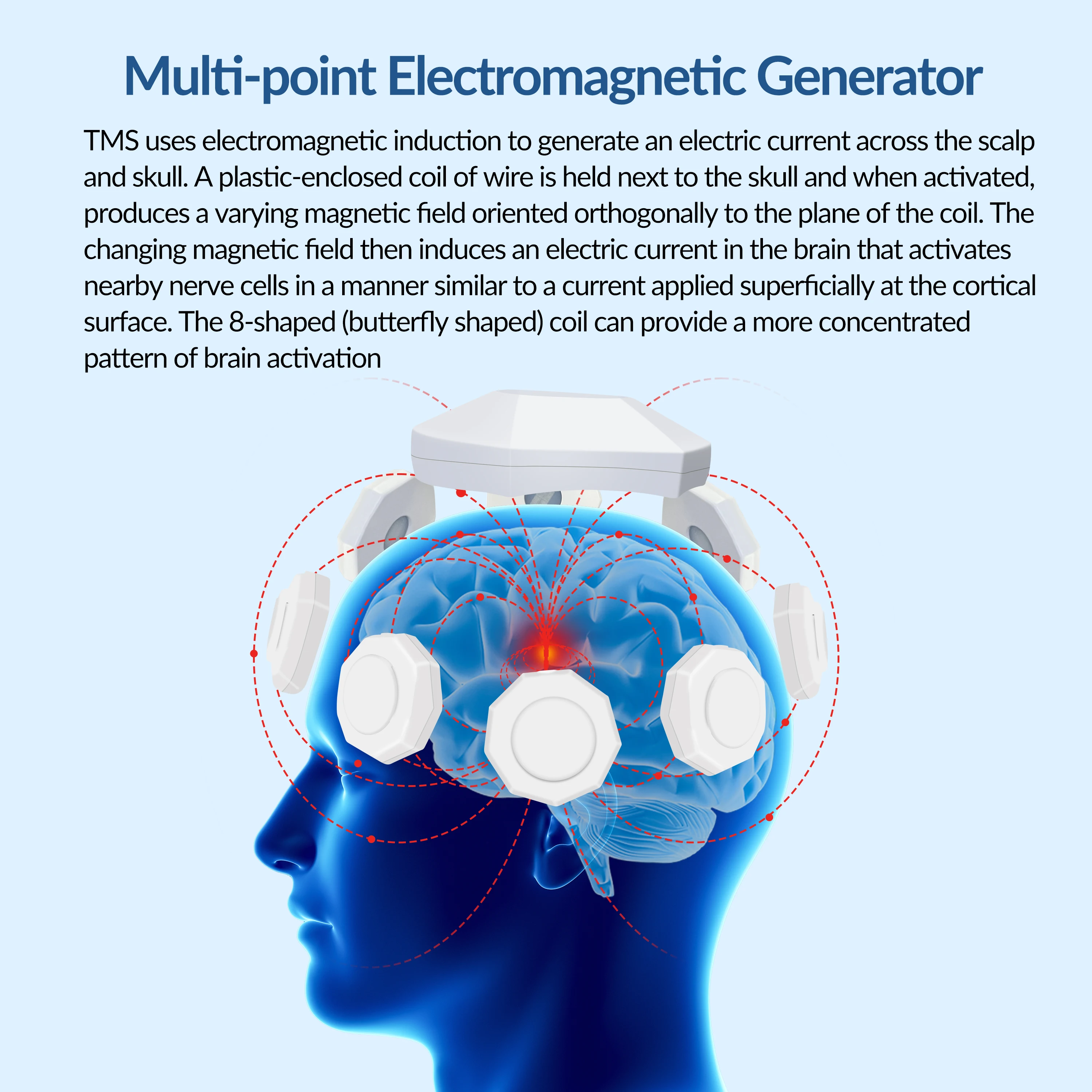 ZJZK TMS Transcranial Magnetic Stimulation Therapy For Depression TMS For Stroke Anxiety Disorders Amyotrophic Lateral Sclerosis