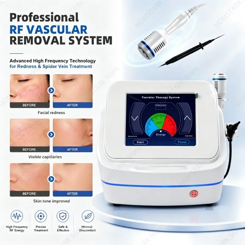 13.56MHz RF High Frequency Beauty Machine, Salon Vascular Skin Care Device, Facial Skin Smoothing & Skin Rejuvenation Equipment