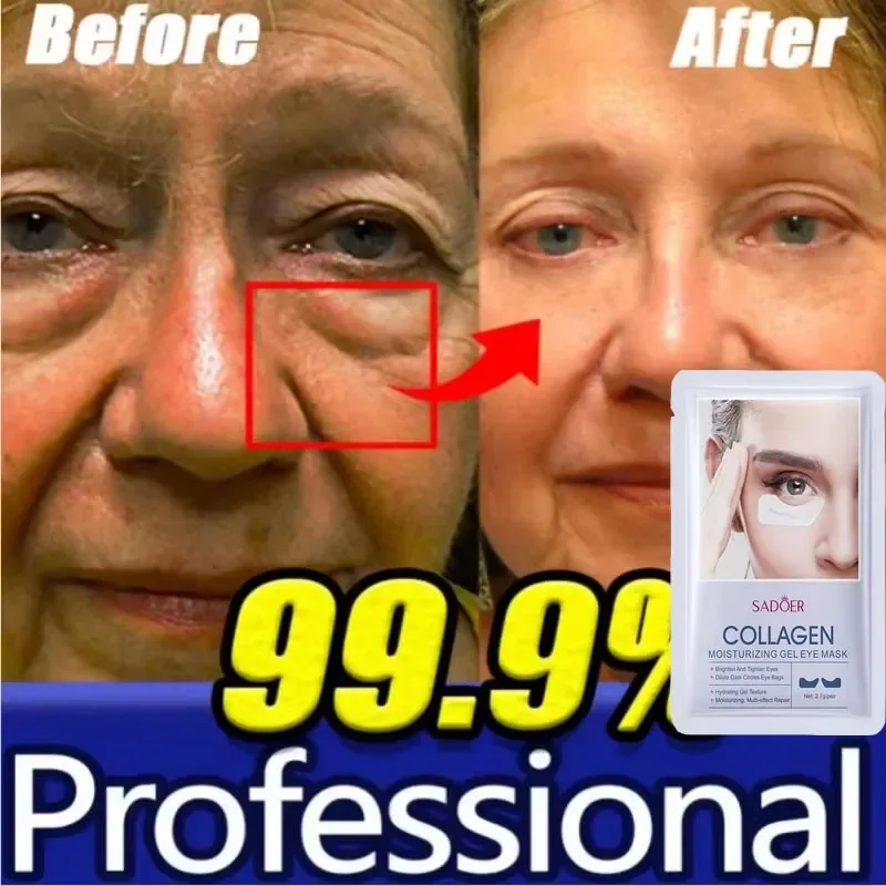 

Eyes Bag Remove Collagen Eye Patch Instant Fade Fine Lines Dark Circles Fat Particles Moisturiz Anti-Puffiness Eye Beauty Care