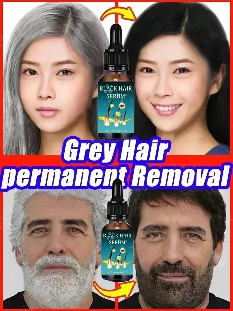 Night white hair old white hair growth ,no allergies Anti-grey essence Serum black  color white