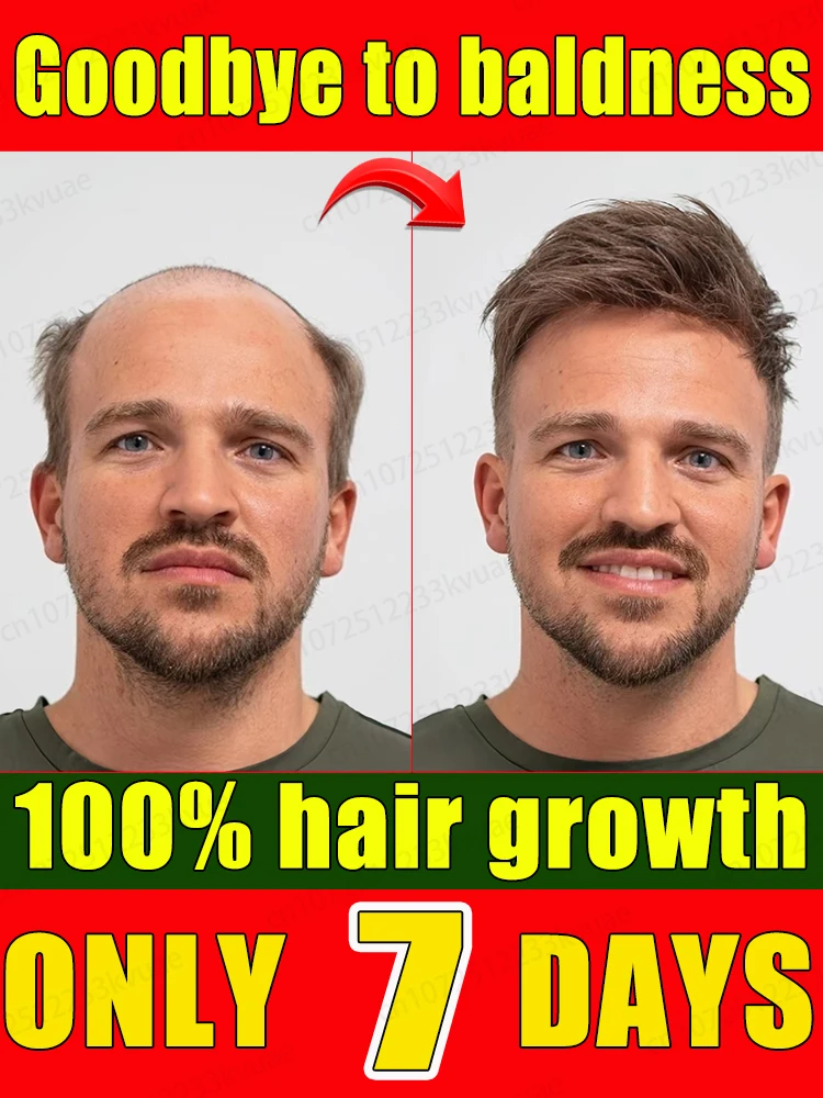 Hair care guide, the new trend. Don't ignore hair problems anymore