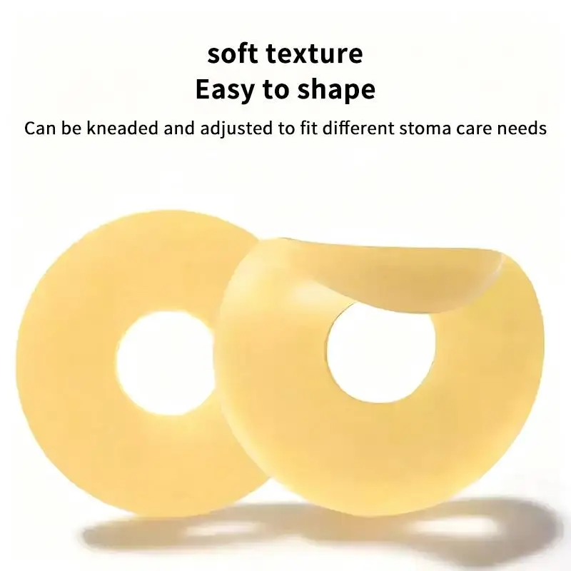 Hot 10Pcs/box Moldable Stoma Barrier Ring Ostomy Leak Proof Ring For One Piece Two Piece Colostomy Bag Stoma Skin Care