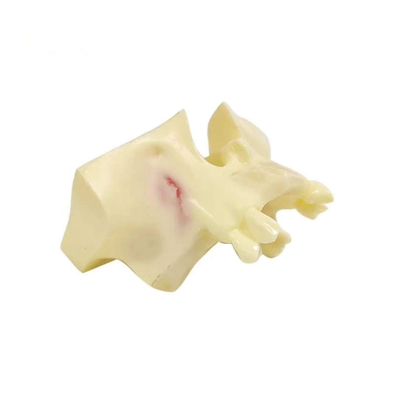 Modelo de dientes de práctica de elevación sinusal UM-Z14