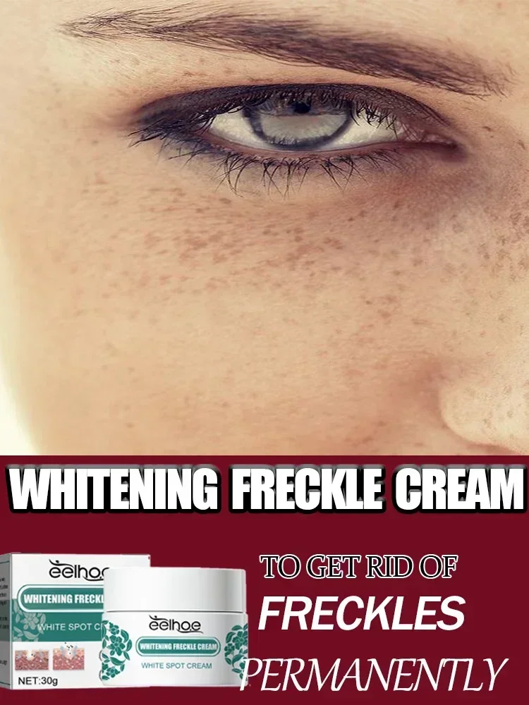 

Reduce Melanin Lighten Dark Skin Whitening Frckle Cream Removal Dark Spots Freckles Brighten Facial Skin Firming Products