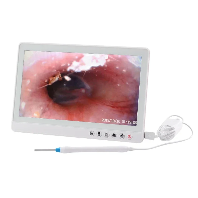 Endoscope Detector Integrated Electronic Nose Endoscope Meatus Acusticus Mirror Ear Pick Visual Ear Cleaning Instrument