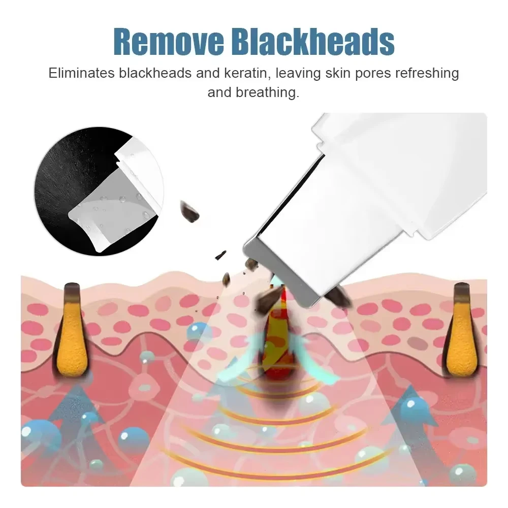 Deep Vibrate Skin Scrubber Facial Cleaner Shovel Spatula Not Ultrasonic Face ScrubberPeeling Blackhead Remover Facial Ma ssager - view 2