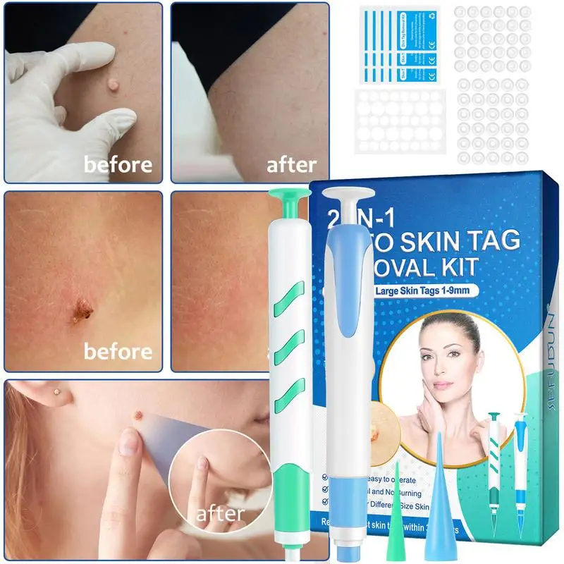 Skin Tags Remover Auto Skin Tags Removal Kit Wart Removal With 30 Small And Large Skin Tags Bands For 1-4mm Groins Small Warts