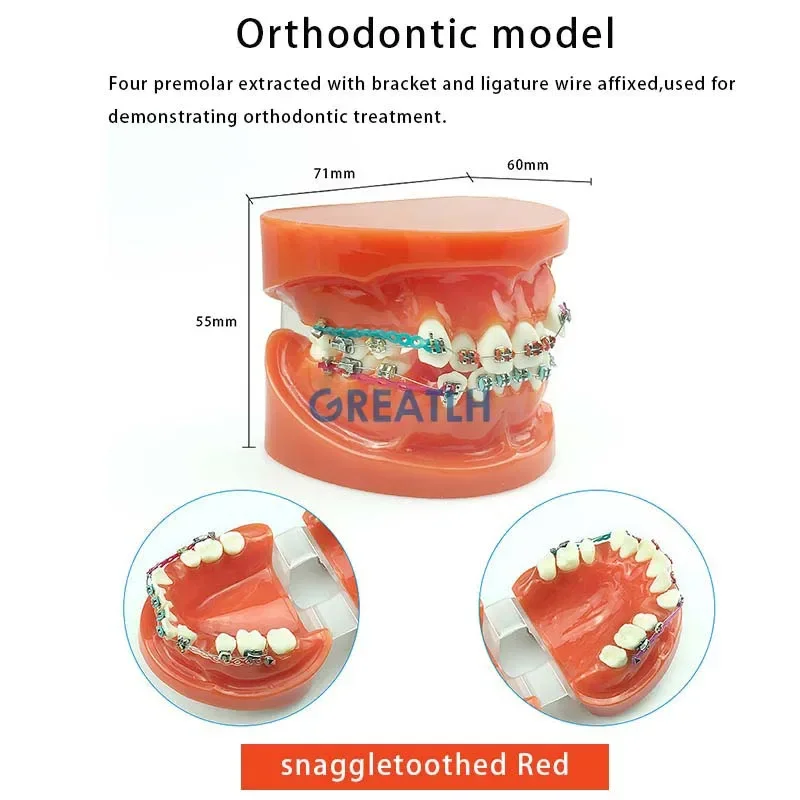 Modelo de ortodoncia Dental, modelo de estudio de dientes, ciencia médica, enseñanza de enfermedades, estudio Dental