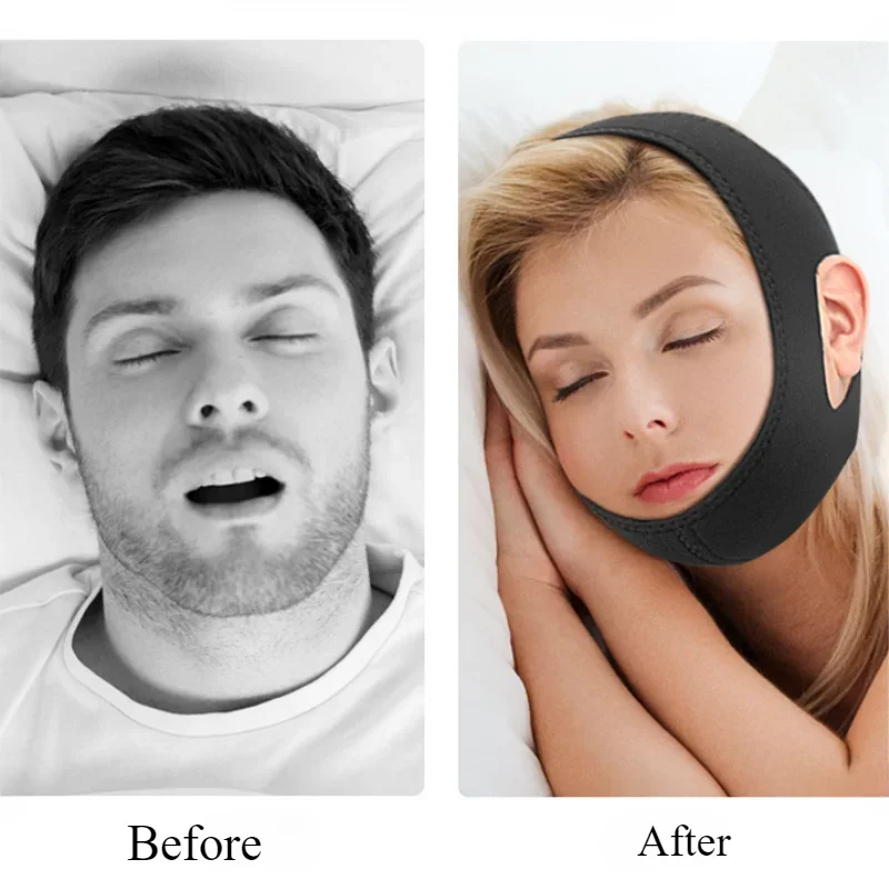 Anti Snore Belt Stop Snoring Chin Strap Woman Man Night Sleeping Support Aid Tools Snoring Protection Jaw Bandage Health Care