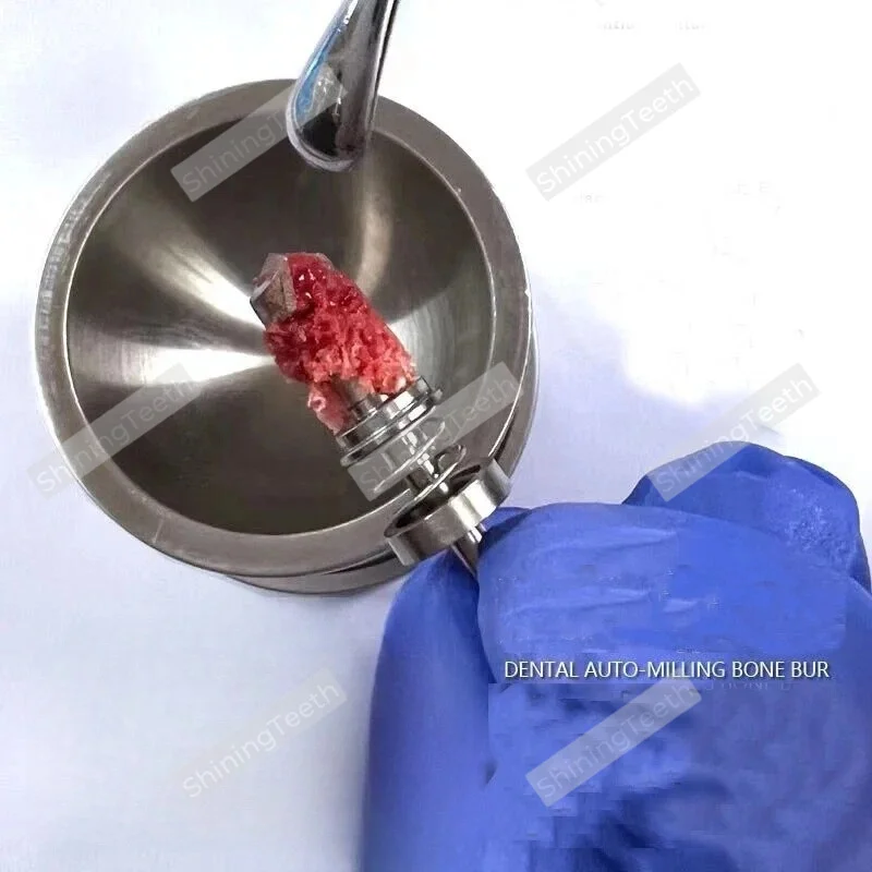 Dental Trephine Burs Extraction Drill Autogenous Bone Self-grinding Bone Drill Implant Bone Spring Bone Harvesting Drill 2.8mm