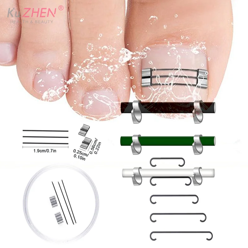 Корректор-вросшего-ногтя-зажим-для-скоб-инструменты-для-восстановления-педикюра-лечение-вросших-ногтей-профессиональное-выпрямление-вросших-ногтей