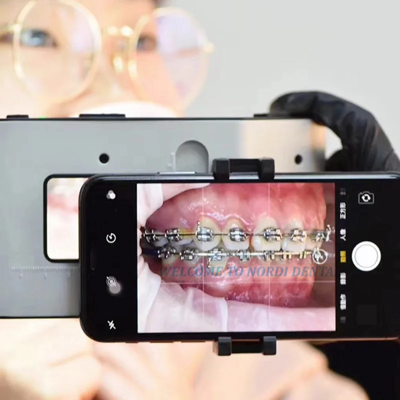 Mobilna oświetlenie fotograficzne dentystyczna | Uchwyt na telefon LED do fotografii dentystycznej 6500K | Ustne światło LED do fotografii mobilnej