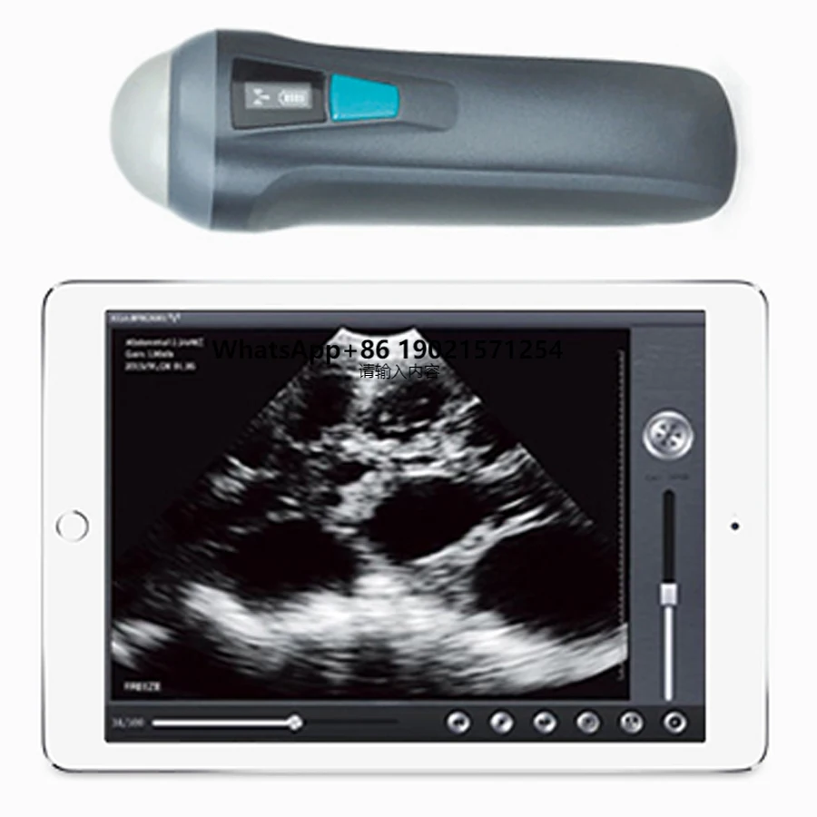 

V1 Veterinary Handheld Ultrasound Scanner for Cows Cat Dog Pig Cattle Sheep Horse Pet