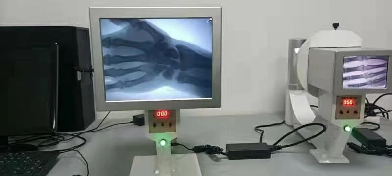 Mesin x-ray portabel termurah mesin fluoroskopi genggam Harga untuk dijual