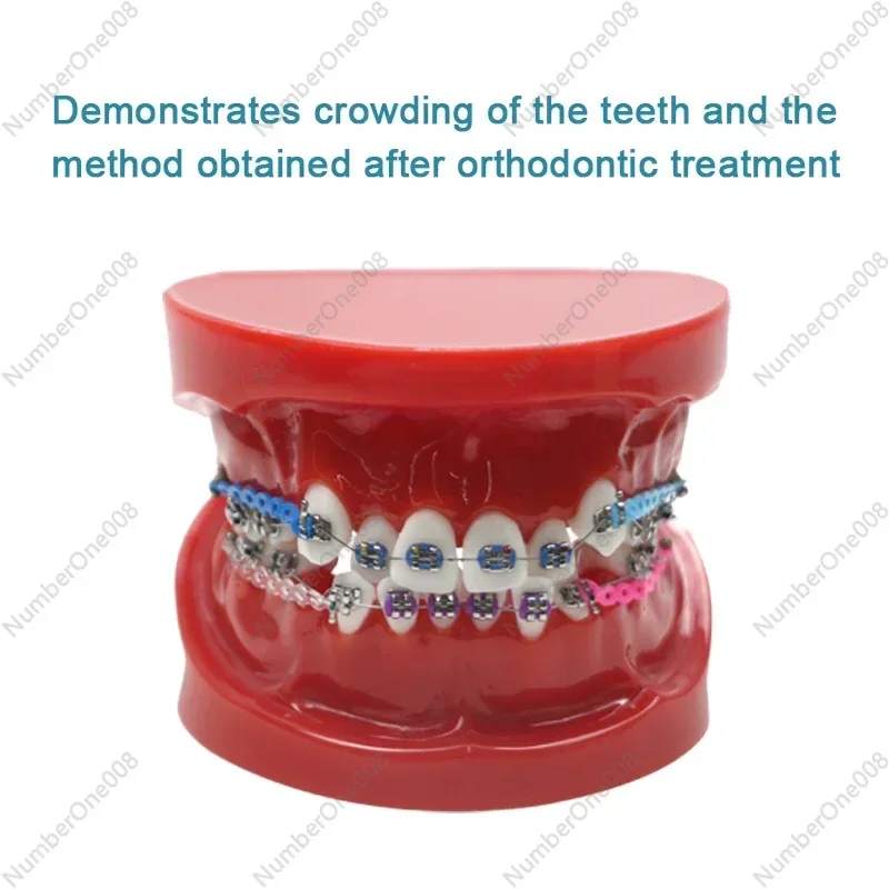 

Orthodontics Teeth Model Dentals Typodonts Orthodontics Teeth Model 1:1 Standards Demo Dentals Supplies