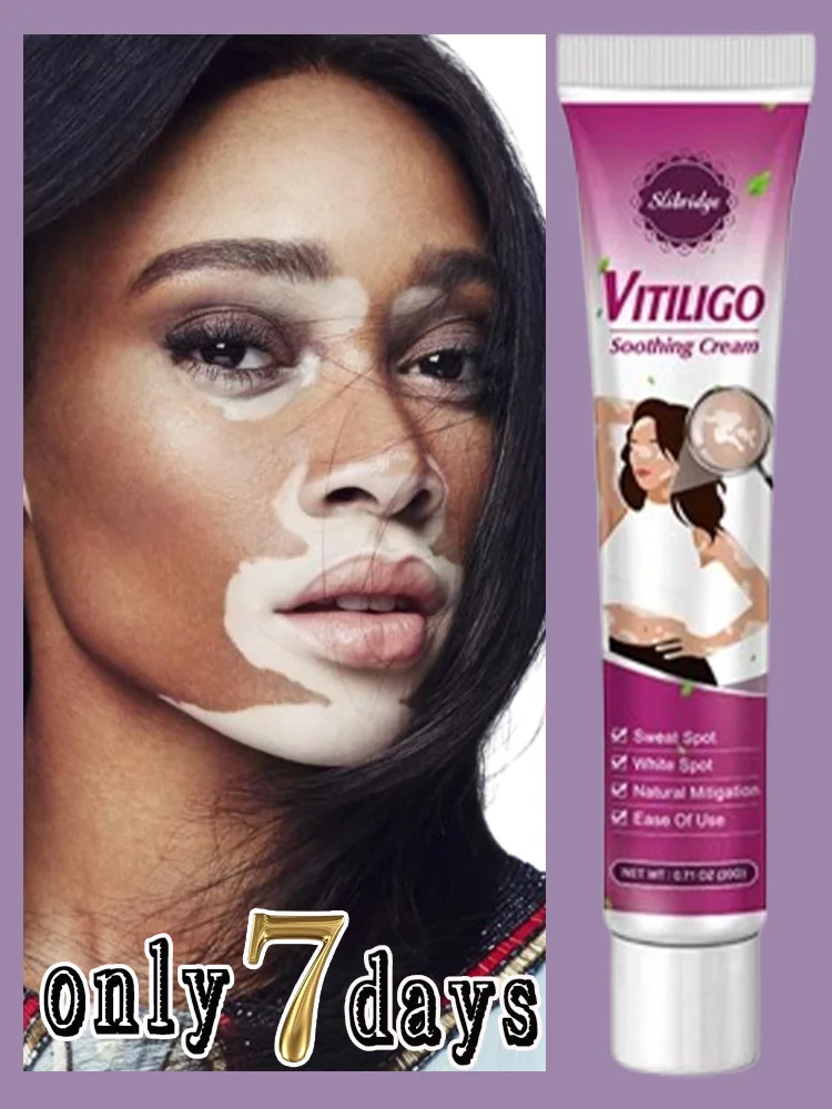 Crema Vitiligine Crescita Rapida Macchie Bianche