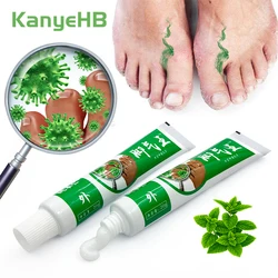 2pcs Foot Beriberi Treatment Cream For Foot Odor Tinea Pedis Anti-itch Inhibits Fungus Athlete Foot Care Medical Ointment A1066